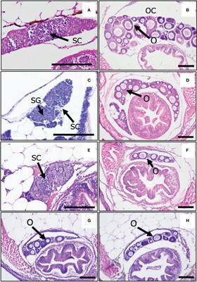 Oxidative Stress Causes Masculinization of Genetically Female Medaka Without Elevating Cortisol